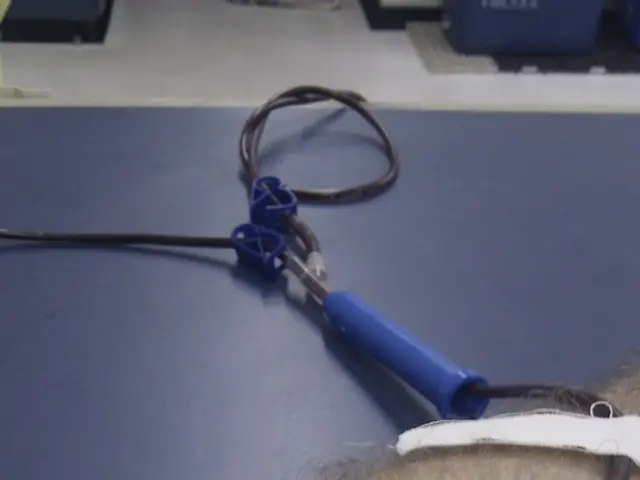 Life Story on Dialysis: Woman Discovers New Kidney, Declaring, "God Found the Perfect Match."